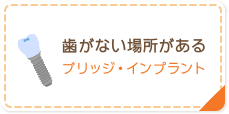 歯がない場所がある プリッジ・インプラント